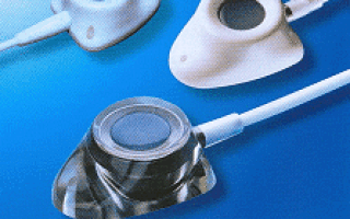 Les chambres à cathéter implantables ou Dispositifs veineux implantables (DVI)