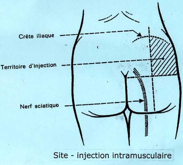 L Injection Intramusculaire Guide Ide