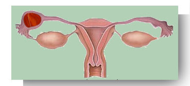 La grossesse extra-utérine (GEU)